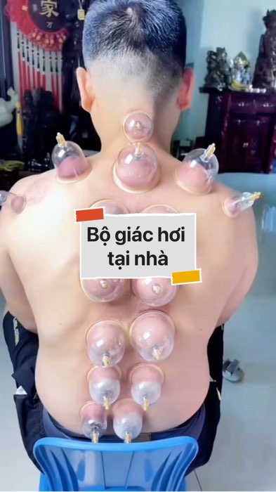 Bộ giác hơi tại nhà #VideohangDoiSong#ShopeeVideo#ShopeeCreator #LuotVuiMuaLien#KOLUyTin#Videomuasam #SandealcungKOL #diumi955