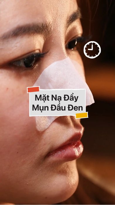 ￼Mặt Nạ Đẩy Mụn Đầu Đen #VideohangLamDep#shopeestyle#ShopeeVideo#ShopeeCreator #LuotVuiMuaLien#KOLUyTin#Videomuasam #SandealcungKOL #diumi252